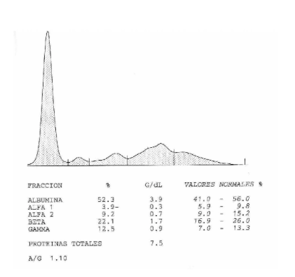 Proteinograma de suero canino normal
