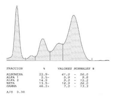 Patrón típico de un proceso hepático severo